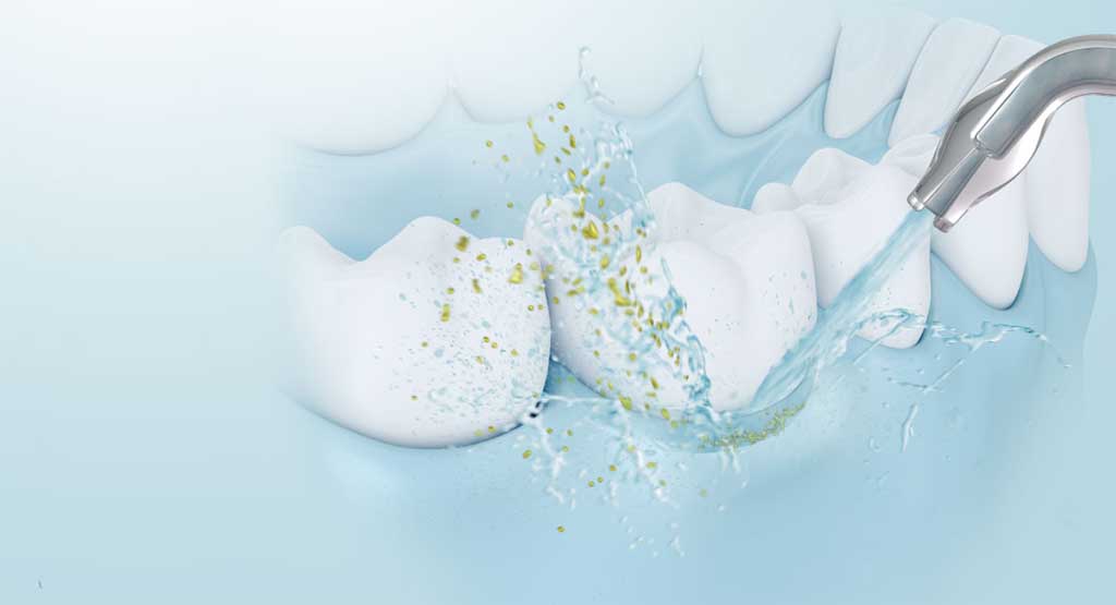 Máy tăm nước công nghệ sóng siêu âm giúp kích thích nước nhẹ nhàng và chăm sóc nướu hiệu quả